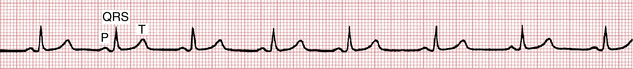 ECG Basics: Waves, Intervals, and Segments | Thoracic Key