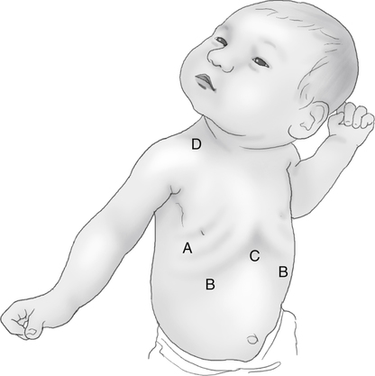 Neonatal and Pediatric Assessment | Thoracic Key