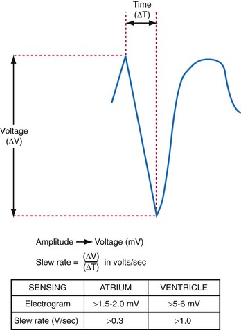 Sensing and Detection | Thoracic Key