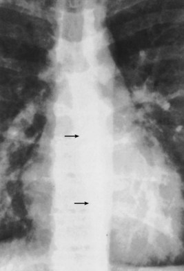 Imaging Techniques | Thoracic Key