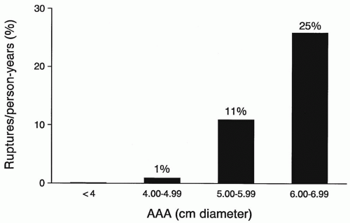 Aneurysms and Aortic Dissection | Thoracic Key