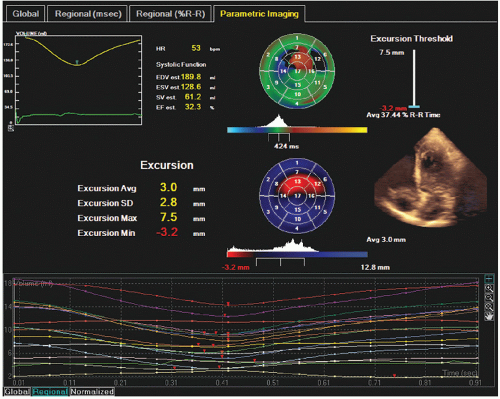 Evaluation of Systolic Function of the Left Ventricle | Thoracic Key