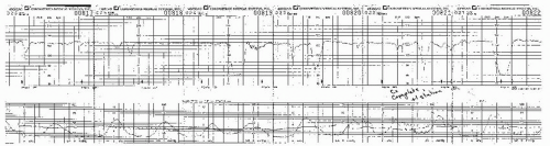 Clinical Management of Abnormal Fetal Heart Rate Patterns | Thoracic Key