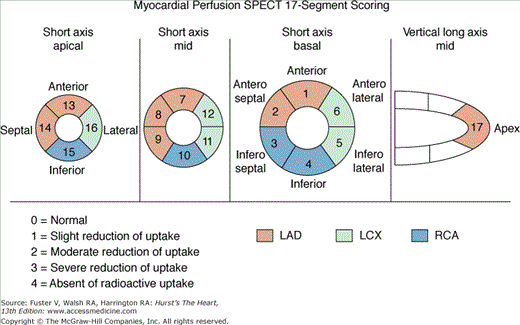 Nuclear Cardiology | Thoracic Key