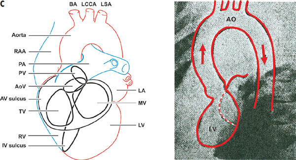 Left and Right Ventriculography, Aortography, and Pulmonary Angiography ...