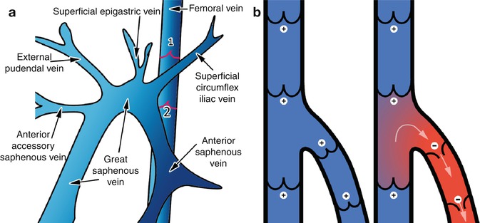 Ultrasound for Reflux | Thoracic Key