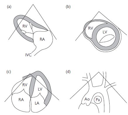 Cardiac investigations | Thoracic Key