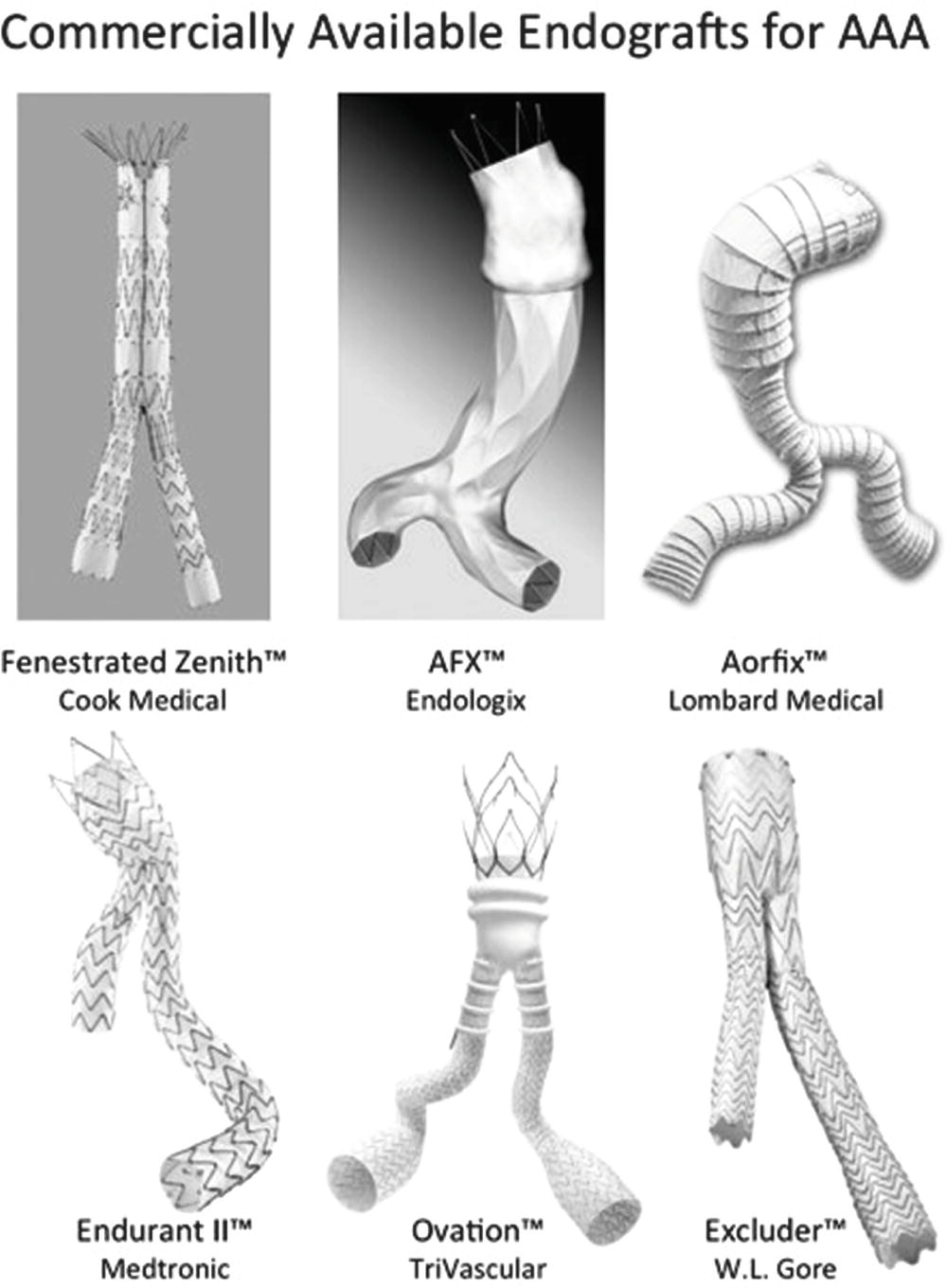 Duplex Assessment of Aortic Endografts Thoracic Key