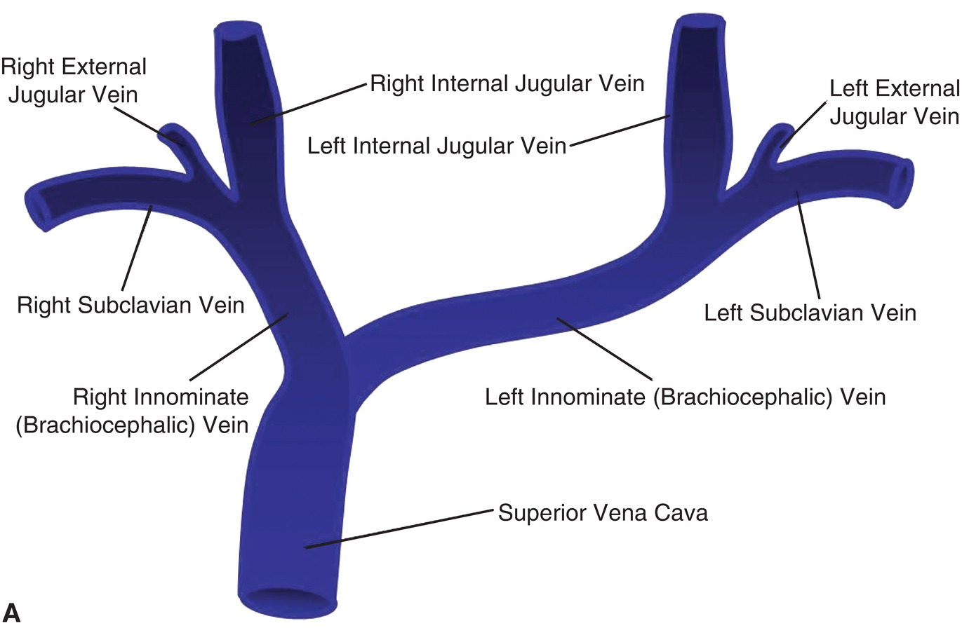 Brachiocephalic Vein Tributaries brachiocephalic-vein-tributaries