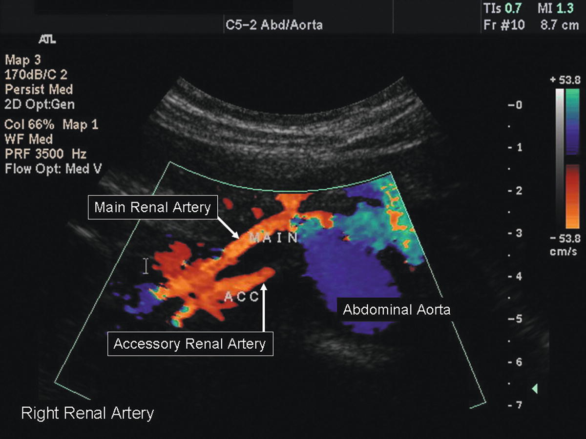 Renal Duplex Scanning Thoracic Key